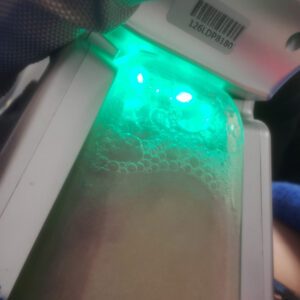 cryolipolyse_cryox_03